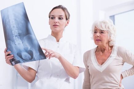 Лекарят показва на пациента X -Ray снимка на гръбначния стълб