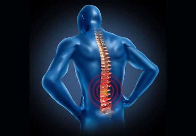 Остеохондрозата на лумбалния гръбнак е заболяване, което се среща при повечето хора