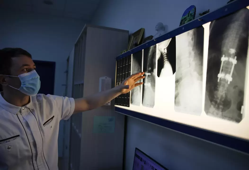 Лекарите диагностицират цервикалната остеохондроза с помощта на инструментални методи, например радиография